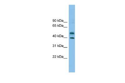 Western Blot: ZNF784 Antibody [NBP2-83906]