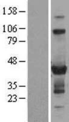 Western Blot: ZNF784 Overexpression Lysate [NBL1-18251]