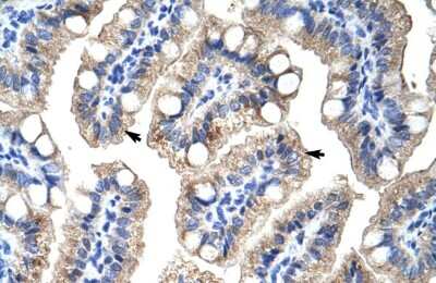 Immunohistochemistry: ZNF785 Antibody [NBP2-83908]