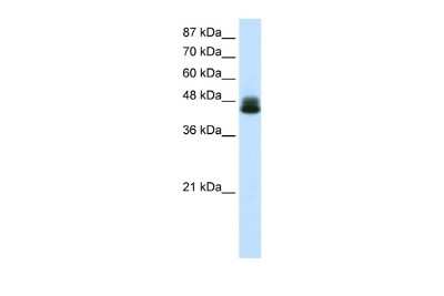 Western Blot: ZNF785 Antibody [NBP2-83907]