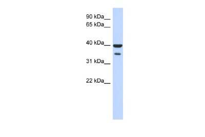 Western Blot: ZNF785 Antibody [NBP2-83909]