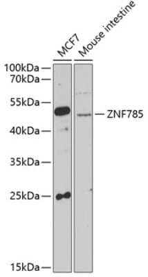 Western Blot: ZNF785 AntibodyAzide and BSA Free [NBP2-93647]