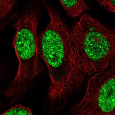 Immunocytochemistry/ Immunofluorescence: ZNF786 Antibody [NBP2-55340]
