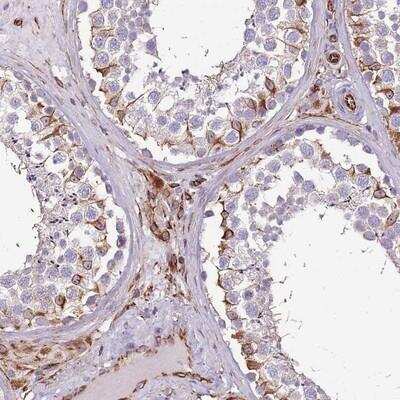 Immunohistochemistry: ZNF786 Antibody [NBP2-13596]