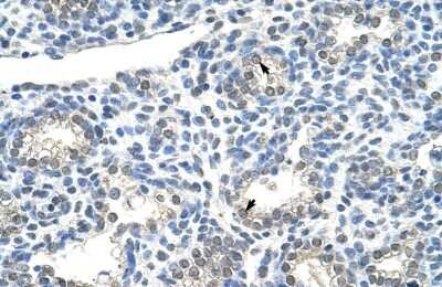 Western Blot: ZNF786 Antibody [NBP1-80405]