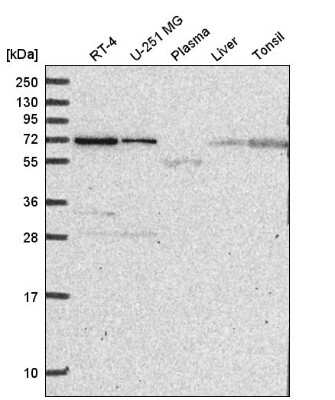 Western Blot: ZNF786 Antibody [NBP2-55340]