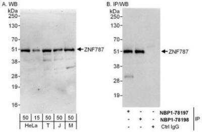 Western Blot: ZNF787 Antibody [NBP1-78197]