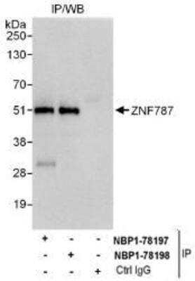 Western Blot: ZNF787 Antibody [NBP1-78198]