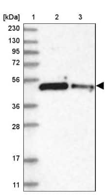 Western Blot: ZNF787 Antibody [NBP1-85911]