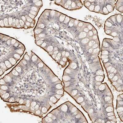 Immunohistochemistry-Paraffin: ZNF789 Antibody [NBP1-86354]