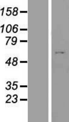 Western Blot: ZNF789 Overexpression Lysate [NBP2-04469]