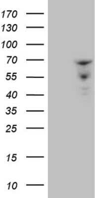 Western Blot: ZNF79 Antibody (OTI3D2) [NBP2-46461]