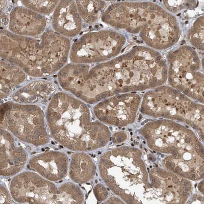 Immunohistochemistry-Paraffin: ZNF79 Antibody [NBP1-80872]