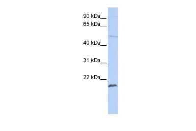 Western Blot: ZNF79 Antibody [NBP2-88744]