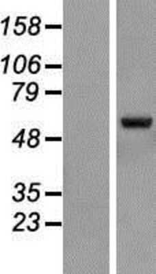 Western Blot: ZNF79 Overexpression Lysate [NBL1-18252]