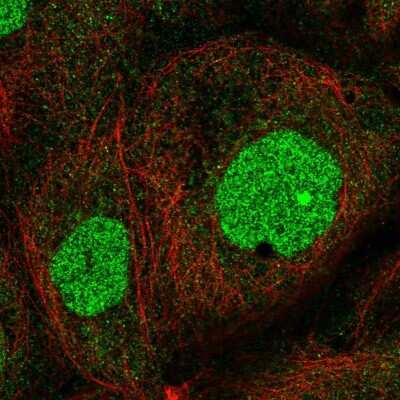 Immunocytochemistry/ Immunofluorescence: ZNF791 Antibody [NBP2-13597]