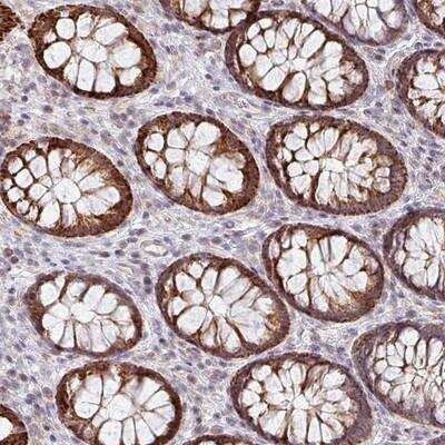 Immunohistochemistry: ZNF791 Antibody [NBP2-13597]