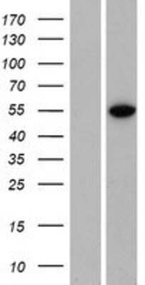 Western Blot: ZNF791 Overexpression Lysate [NBP2-05260]