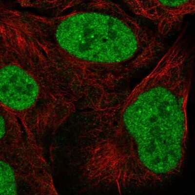 Immunocytochemistry/ Immunofluorescence: ZNF792 Antibody [NBP2-55182]