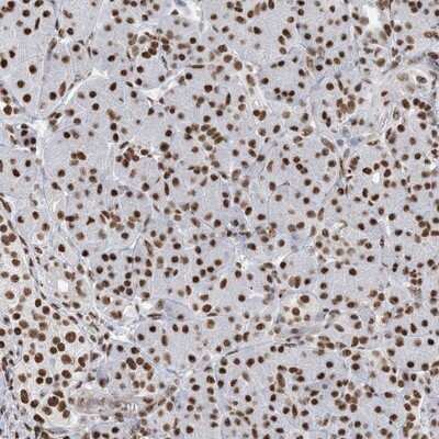 Immunohistochemistry-Paraffin: ZNF792 Antibody [NBP1-81936]
