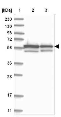 Western Blot: ZNF792 Antibody [NBP1-81936]