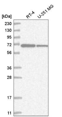 Western Blot: ZNF792 Antibody [NBP2-55182]