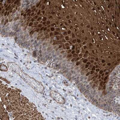 Immunohistochemistry-Paraffin: ZNF8 Antibody [NBP1-81755]