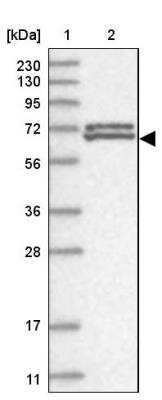 Western Blot: ZNF8 Antibody [NBP1-81754]