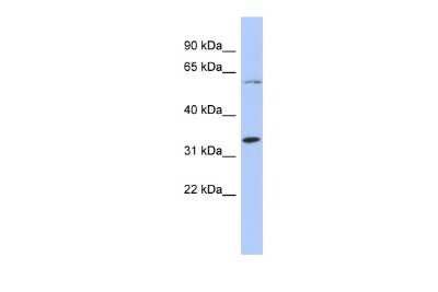 Western Blot: ZNF8 Antibody [NBP2-88749]