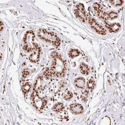 Immunohistochemistry: ZNF80 Antibody [NBP2-38068]