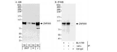 Western Blot: ZNF800 Antibody [NBP1-78199]