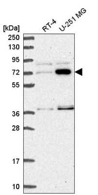 Western Blot: ZNF800 Antibody [NBP2-56679]