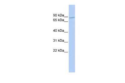 Western Blot: ZNF800 Antibody [NBP2-88751]