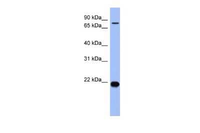 Western Blot: ZNF800 Antibody [NBP2-88752]