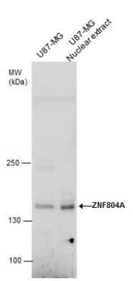 Western Blot: ZNF804A Antibody [NBP2-43681]