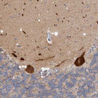 Immunohistochemistry-Paraffin: ZNF804B Antibody [NBP1-82004]