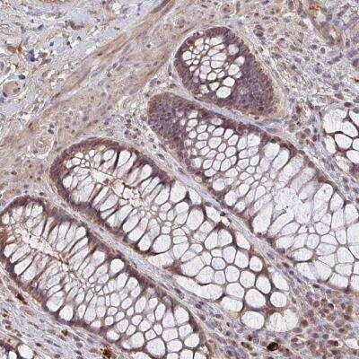 Immunohistochemistry-Paraffin: ZNF805 Antibody [NBP2-32403]