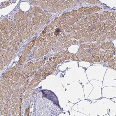 Immunohistochemistry-Paraffin: ZNF805 Antibody [NBP2-33840]