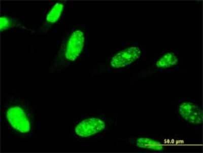 Immunocytochemistry/ Immunofluorescence: ZNF81 Antibody (3G3) [H00347344-M07]