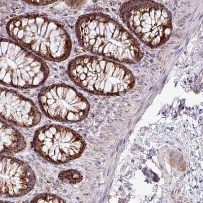 Immunohistochemistry-Paraffin: ZNF81 Antibody [NBP2-13598]