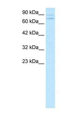 Western Blot: ZNF81 Antibody [NBP1-79990]