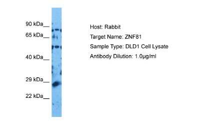 Western Blot: ZNF81 Antibody [NBP2-88753]