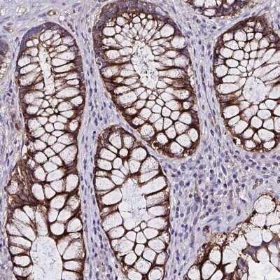 Immunohistochemistry-Paraffin: ZNF813 Antibody [NBP2-31638]