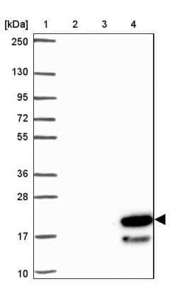 Western Blot: ZNF813 Antibody [NBP2-31638]