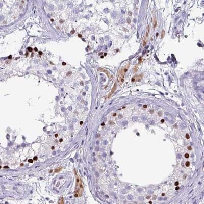 Immunohistochemistry-Paraffin: ZNF816-ZNF321P Antibody [NBP2-14733]