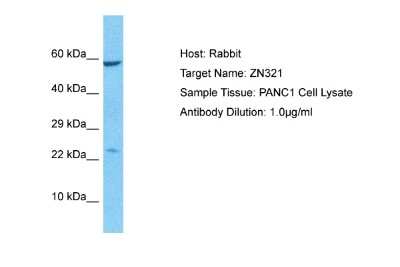 Western Blot: ZNF816-ZNF321P Antibody [NBP2-83911]