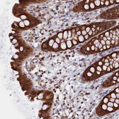 Immunohistochemistry-Paraffin: ZNF816A Antibody [NBP1-80585]