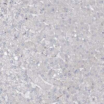 Immunohistochemistry-Paraffin: ZNF821 Antibody [NBP1-86290]