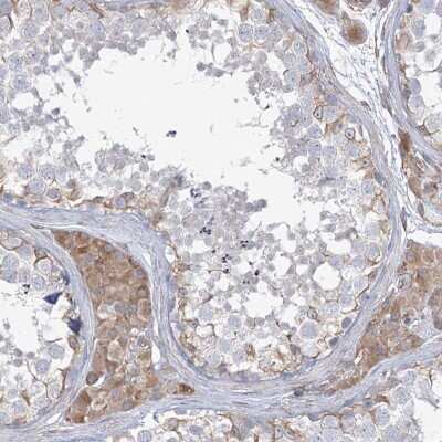 Immunohistochemistry-Paraffin: ZNF821 Antibody [NBP1-86290]