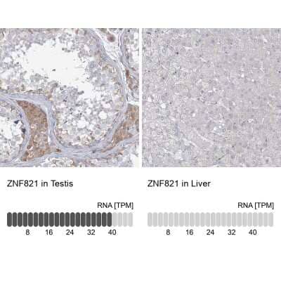 Immunohistochemistry-Paraffin: ZNF821 Antibody [NBP1-86290]